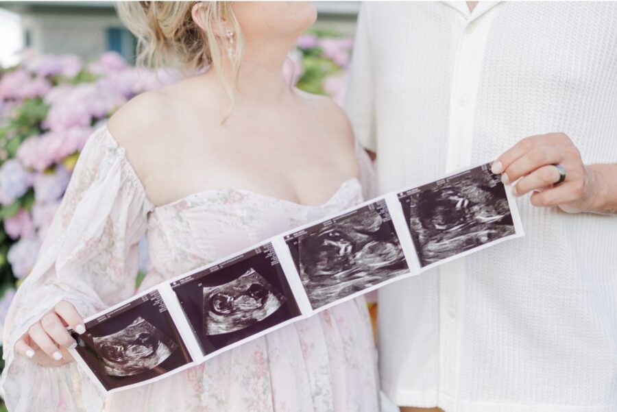 A close up of sonogram images with a man and a woman holding each end of the photographs in the background.